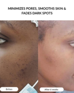 BHA Exfoliating Serum - Image 5