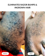BHA Exfoliating Serum - Image 6
