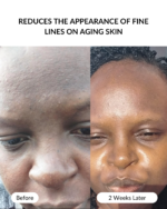 BHA Exfoliating Serum - Image 4