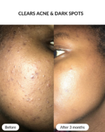 BHA Exfoliating Serum - Image 2